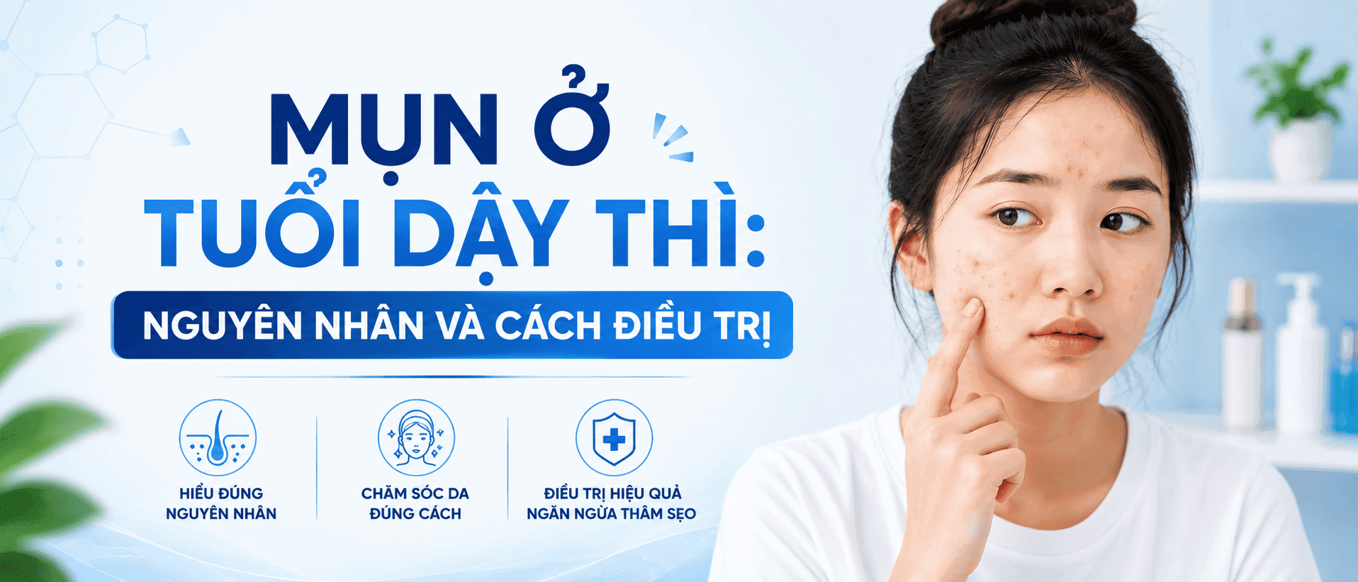 Mụn Ở Tuổi Dậy Thì: Nguyên Nhân Và Cách Điều Trị