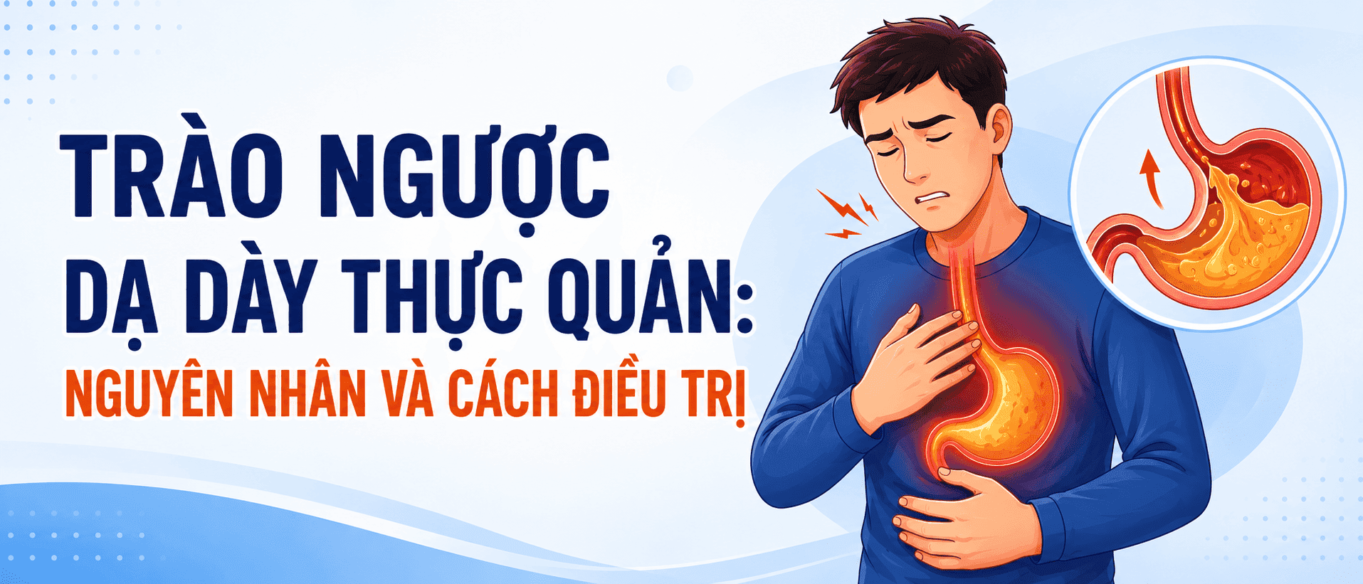 Trào ngược dạ dày thực quản: Nguyên nhân và cách điều trị